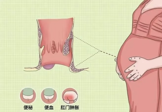微信图片_20250522083654.png